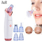 Microderm Profissional - Aparelho Removedor de Cravos
