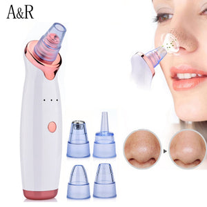 Microderm Profissional - Aparelho Removedor de Cravos